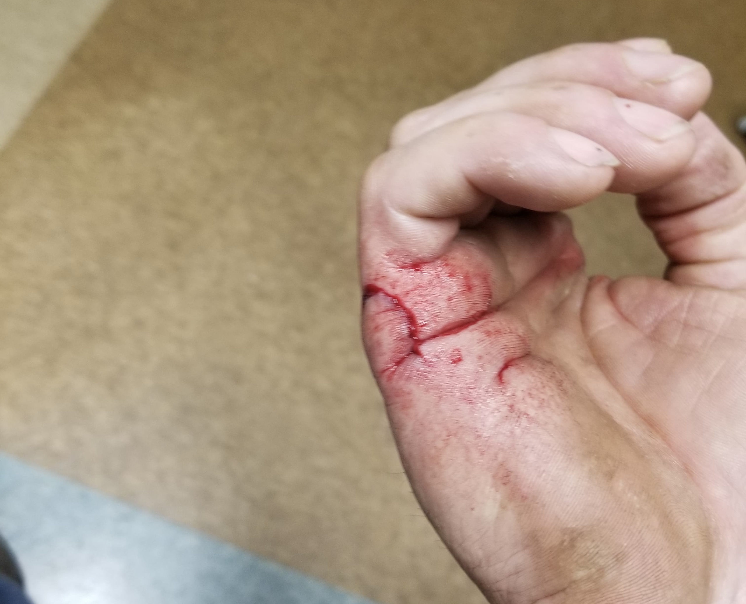 Working Wounded